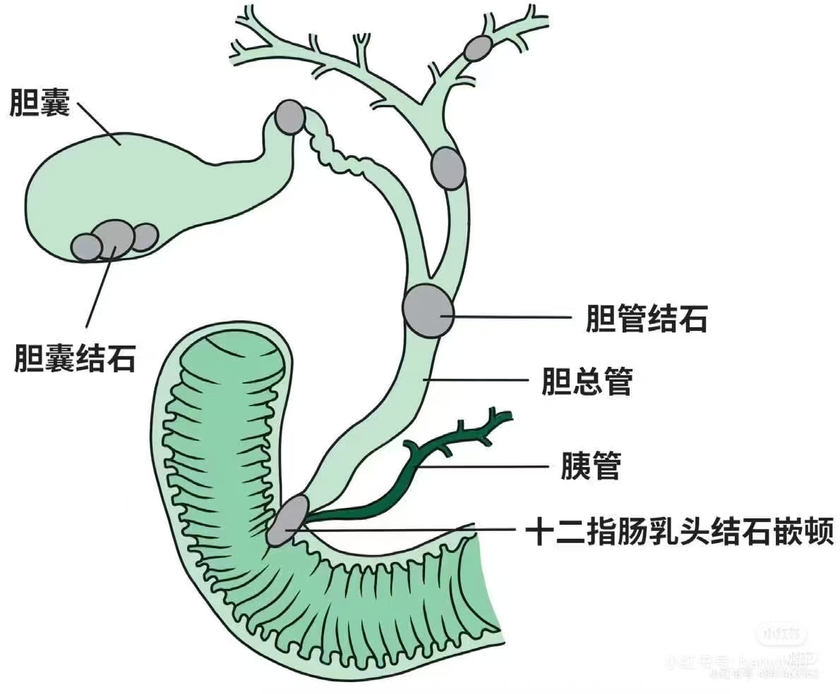 a06cd3894419eb8c9202ff6bcc84590.jpg