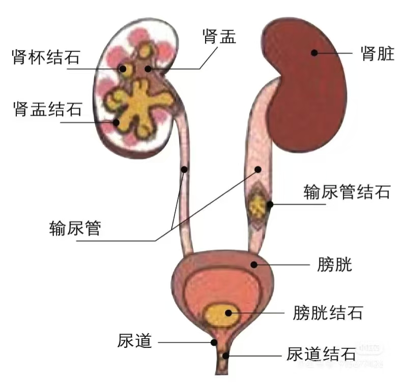 72c211dab797eaa412984e169f5d475.jpg